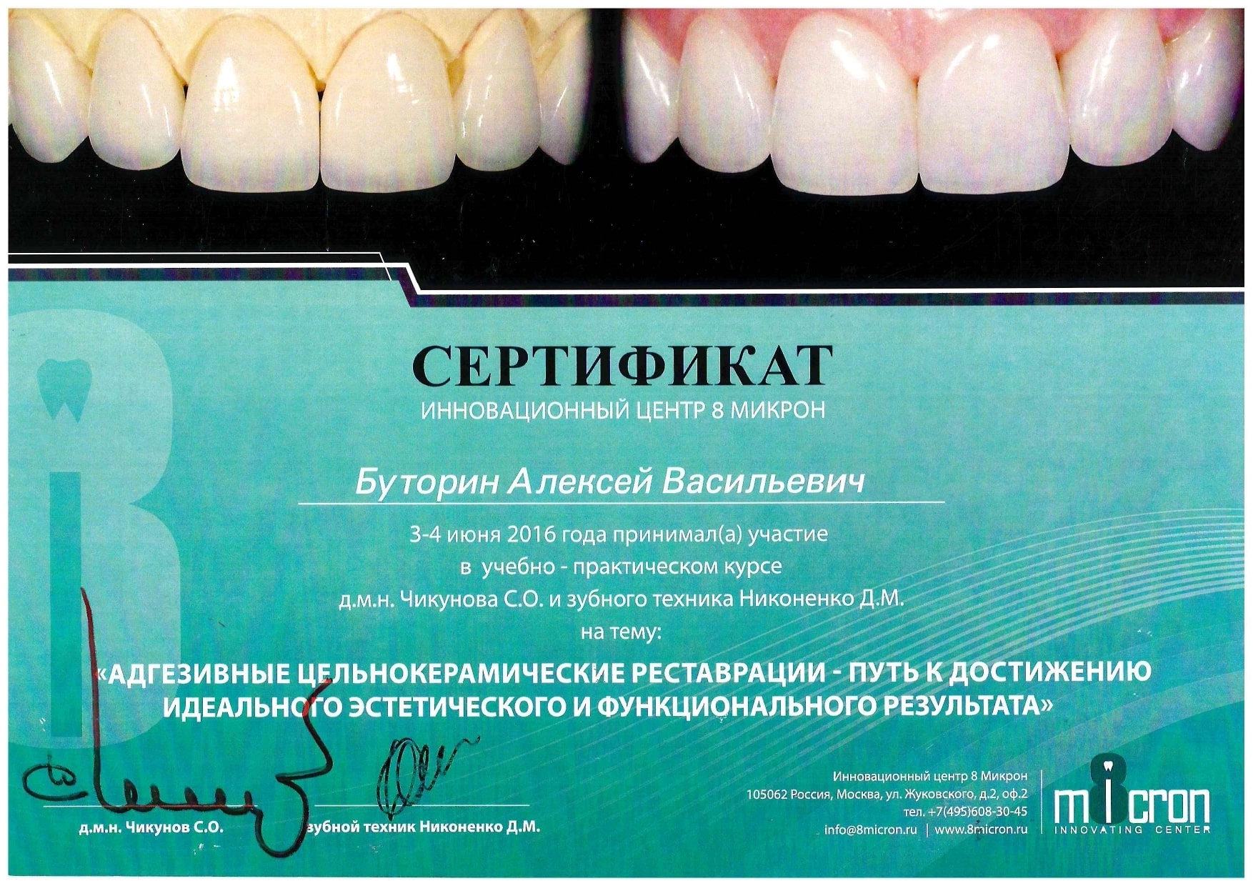 Буторин Алексей Васильевич. Адгезивные цельнокерамические реставрации - путь к достижению идеального эстетического и функционального результата